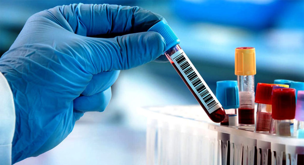 Como Interpretar Un Test Serologico El test serológico argentino para COVID-19 llegó a los 100.000 ensayos